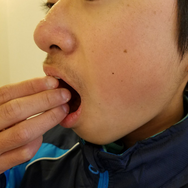 after画像